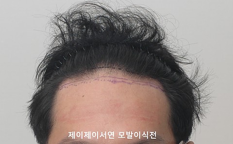 전후사진 