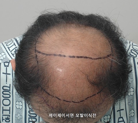 전후사진 