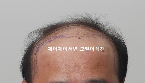 가발 안녕. 