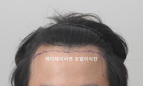 3500모 경과 