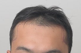 블로그에서 옮긴 전후사진 