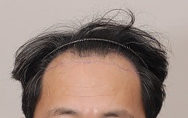 블로그에서 옮긴 전후사진 