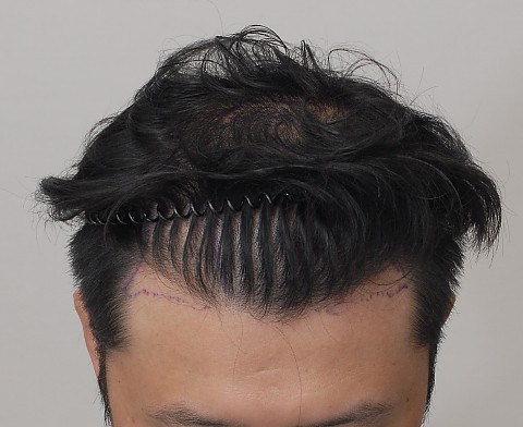 블로그에서 옮긴 전후사진 
