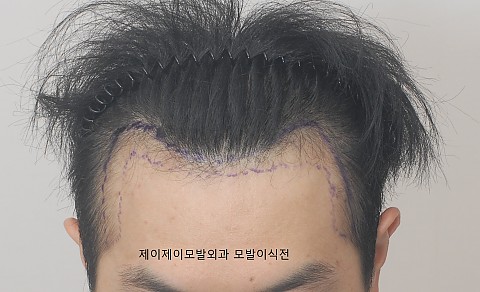 블로그에서 옮긴 전후사진, 