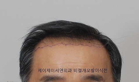 블로그에서 옮긴 전후사진 